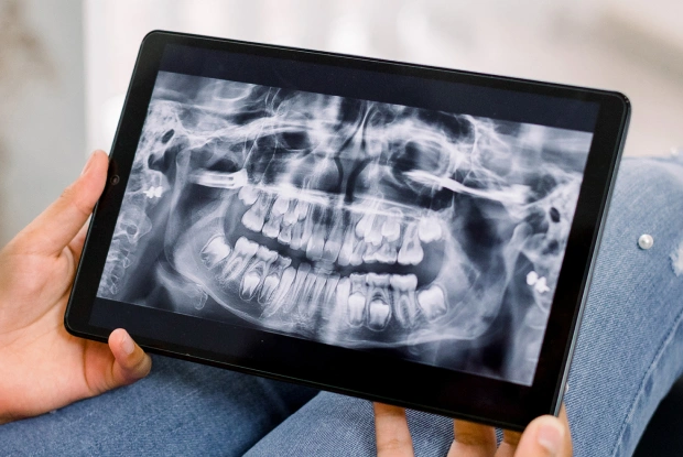 Hand holding tablet displaying dental X-ray of teeth and jaw structure