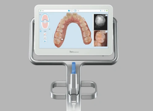 Digital dental scanner displaying 3D model of dental arch with detailed intraoral images on screen.
